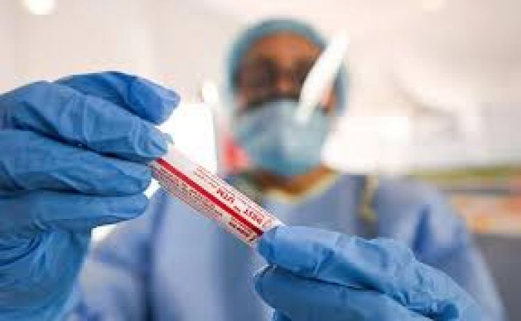 Salud informa sobre 898 nuevos contagios y 17 muertes por coronavirus