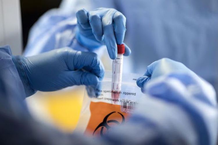 Salud reporta 747 nuevos casos y 15 muertes por coronavirus