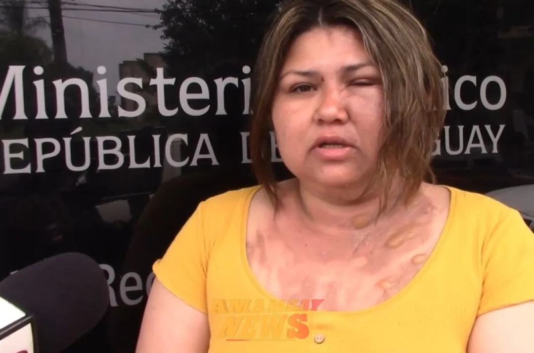 Encarnación: una mujer denunció que le derramaron agua caliente