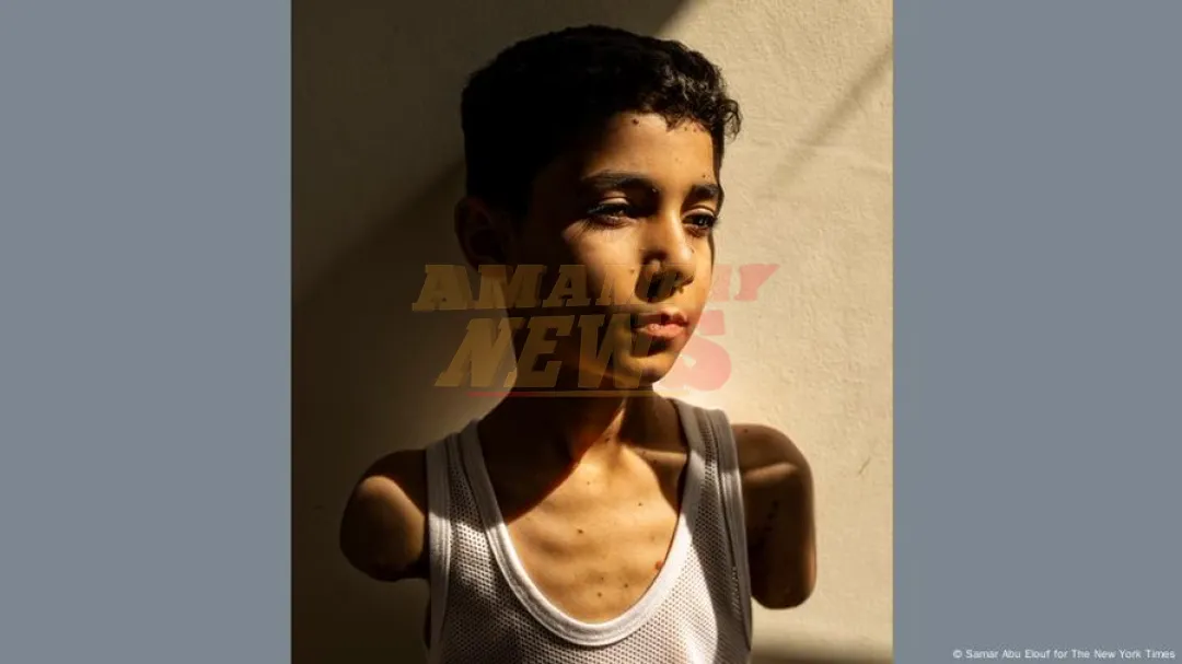 Un niño de Gaza amputado: Foto del Año del World Press Photo