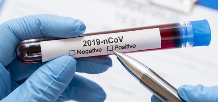 Salud reporta 952 nuevos casos y 14 fallecidos por coronavirus