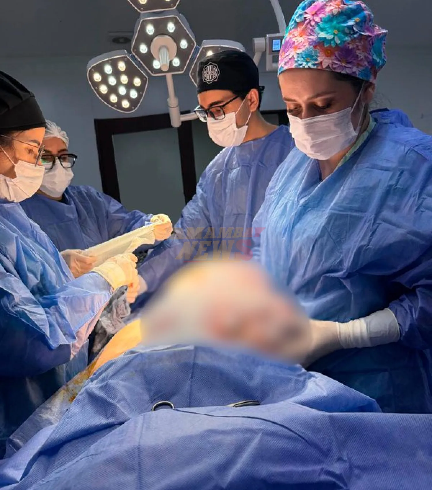 Extirpan tumor ovárico de 11 kilogramos en hospital de Pedro Juan Caballero