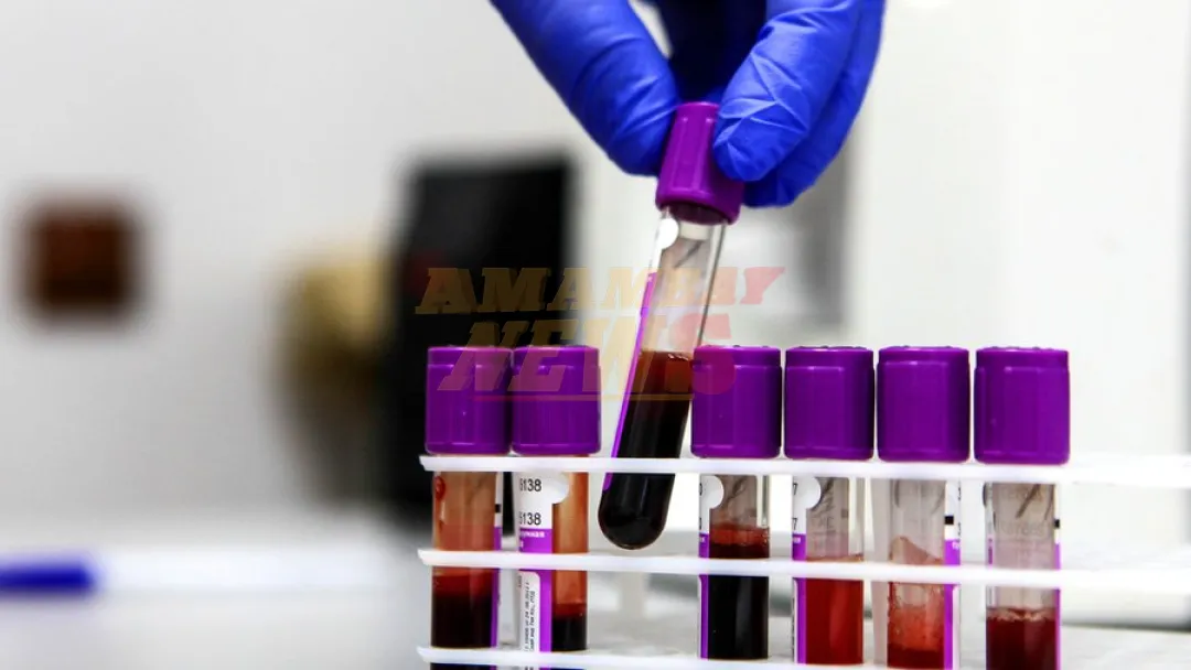 Inician en Rusia los primeros ensayos clínicos de una vacuna contra el cáncer