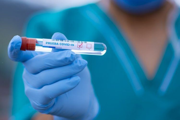 Salud reporta 17 fallecidos y 740 nuevos contagios de Covid-19