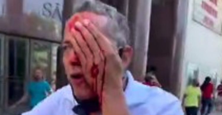 Hombre pierde un ojo en manifestación contra Bolsonaro en Brasil