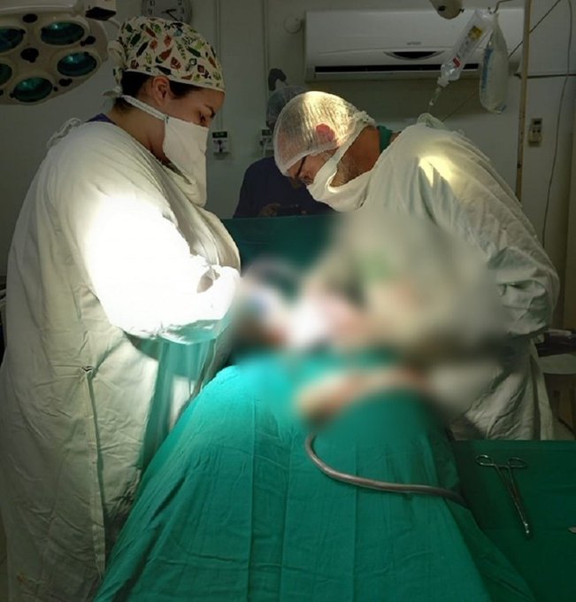 Misiones: extraen tumor de más de 5 kilos a una joven