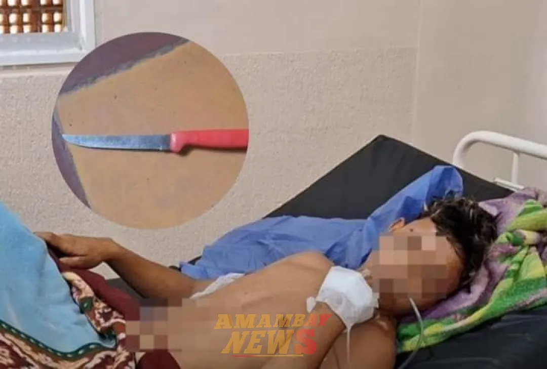 Joven pierde un riñón a causa de un apuñalamiento