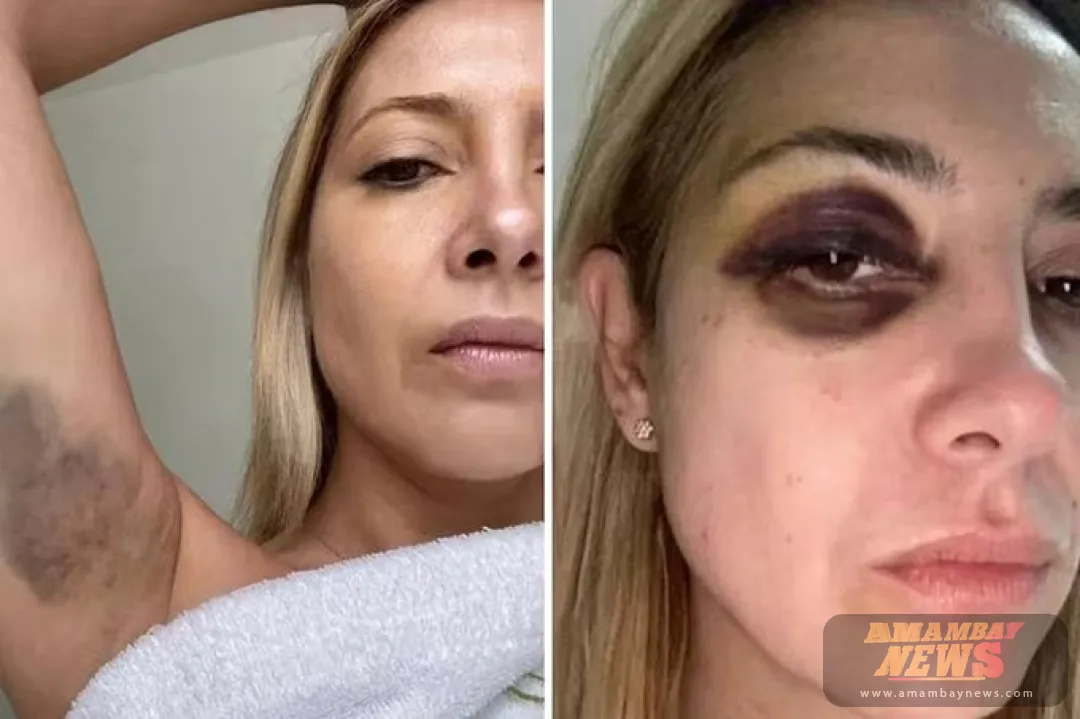 Tras acusación de agresión, sitio web publica fotos de la exmujer de Alberto Fernández