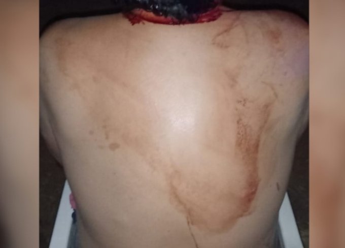 Mujer golpea con martillo a su pareja tras una discusión