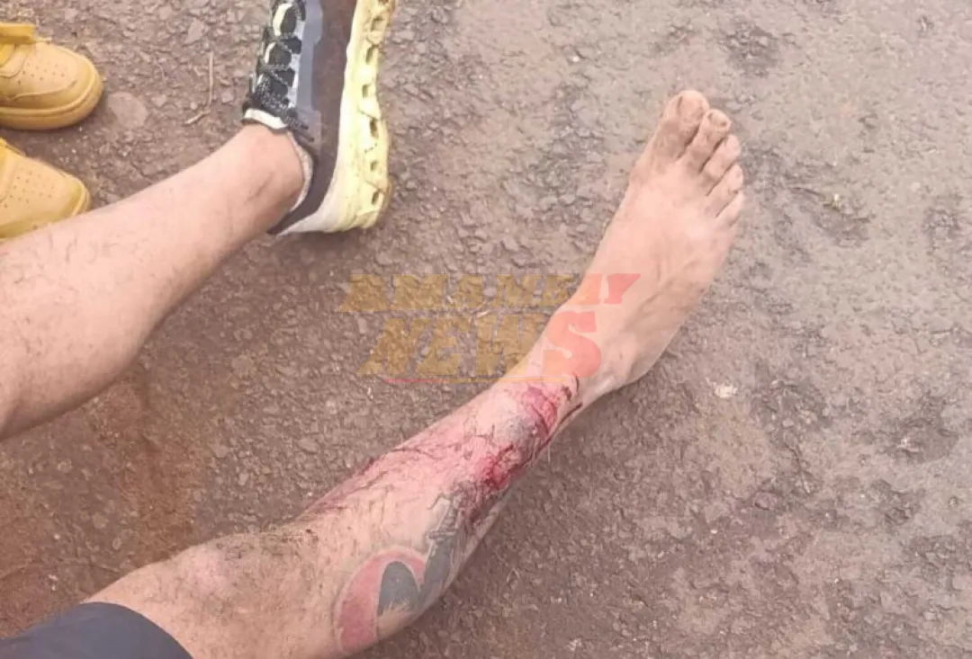 Ponta Porã: Un hombre entrenado en artes marciales evita una tragedia al contener a unos pitbulls en la calle