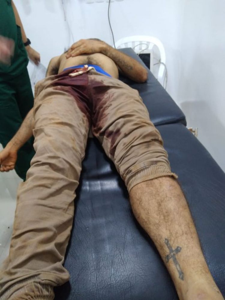 Joven muere tras ser baleado en el muslo durante gresca en asentamiento de CDE