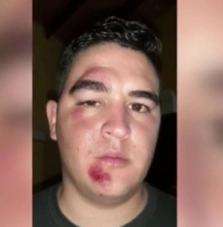 Detienen a presunto ladrón en Luque