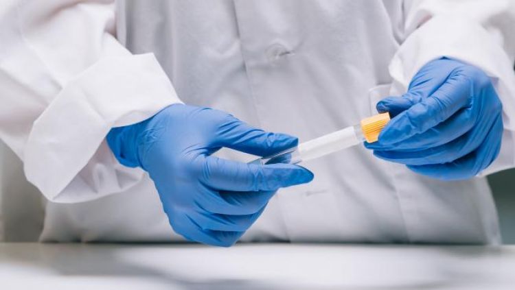 Salud Pública reporta 13 nuevas muertes y 764 contagios por coronavirus