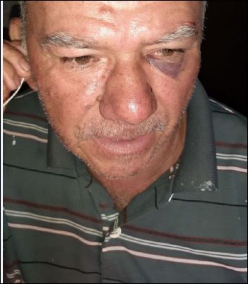 Detienen a un hombre por quemar el auto de su yerno