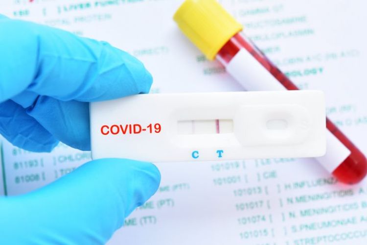 Salud reporta 1.055 contagios y 17 muertes por Covid-19