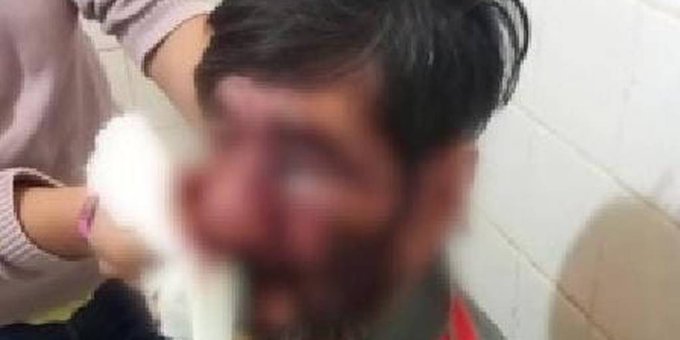 Detienen a un hombre que golpeó brutalmente a su padre en Cainindeyú