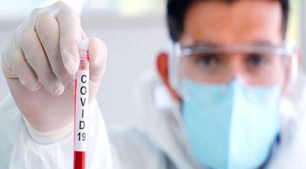 Más del 90% de pacientes con coronavirus son de Asunción y Central