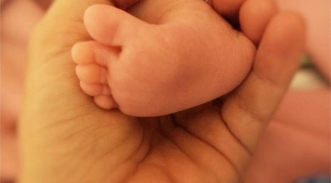 Reportan varios recién nacidos con sífilis en el norte del país