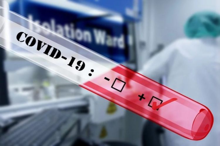 Salud reporta 19 muertos y 751 casos positivos de coronavirus en el país