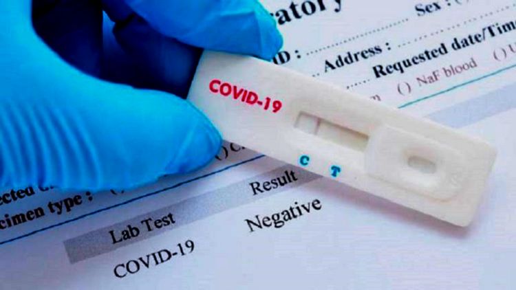 Salud Pública registra 959 nuevos contagios y 16 muertes por coronavirus