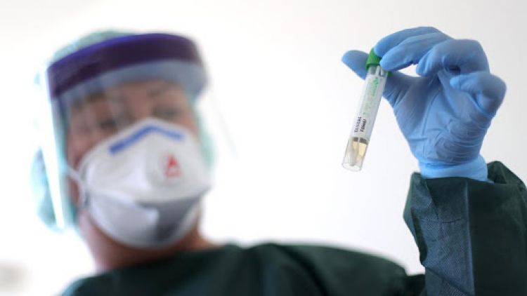 Salud reporta 22 nuevos fallecidos y 861 casos de coronavirus