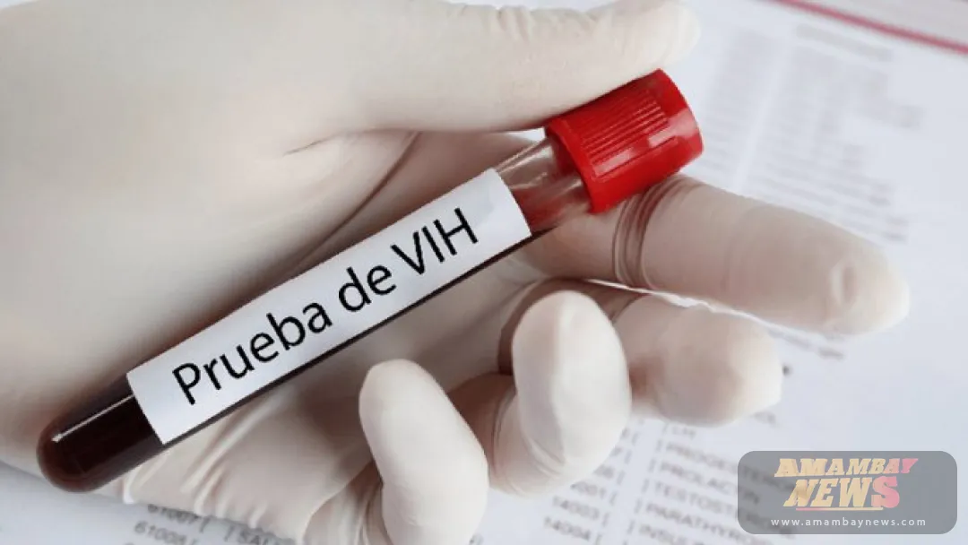 Alto porcentaje de diagnósticos de VIH en Paraguay se detecta en estado avanzado