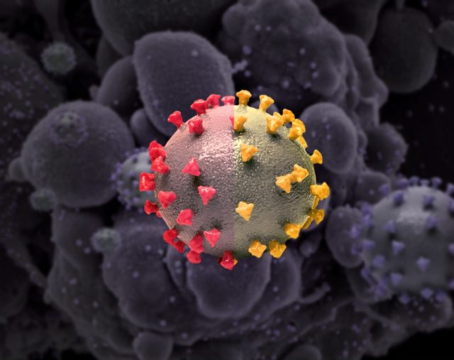 Covid: Brasil registra 79 muertes en 24 horas