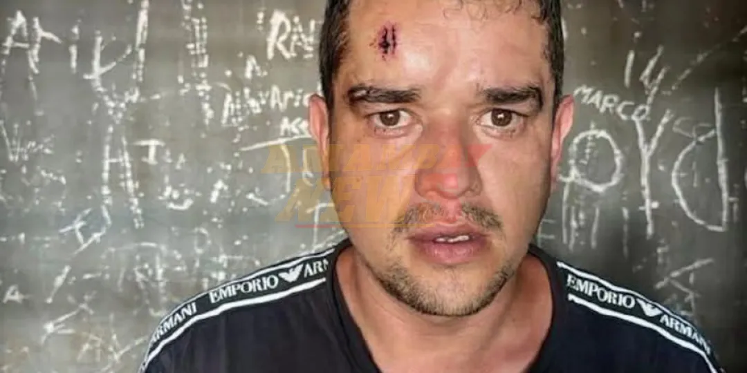 Policía con prisión domiciliaria sufre quemaduras tras provocar incendio en su pieza