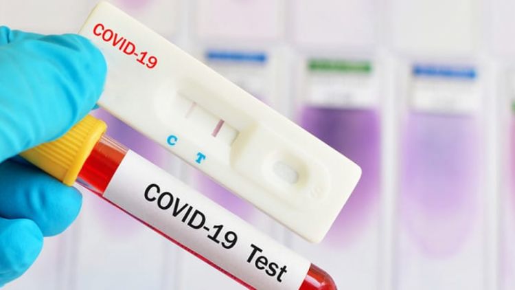 Reportan 8 fallecidos y 520 nuevos casos de Coronavirus en el país
