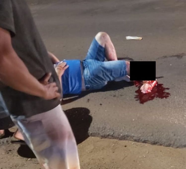 Motociclista perdió una pierna en accidente sobre la línea Internacional de PJC