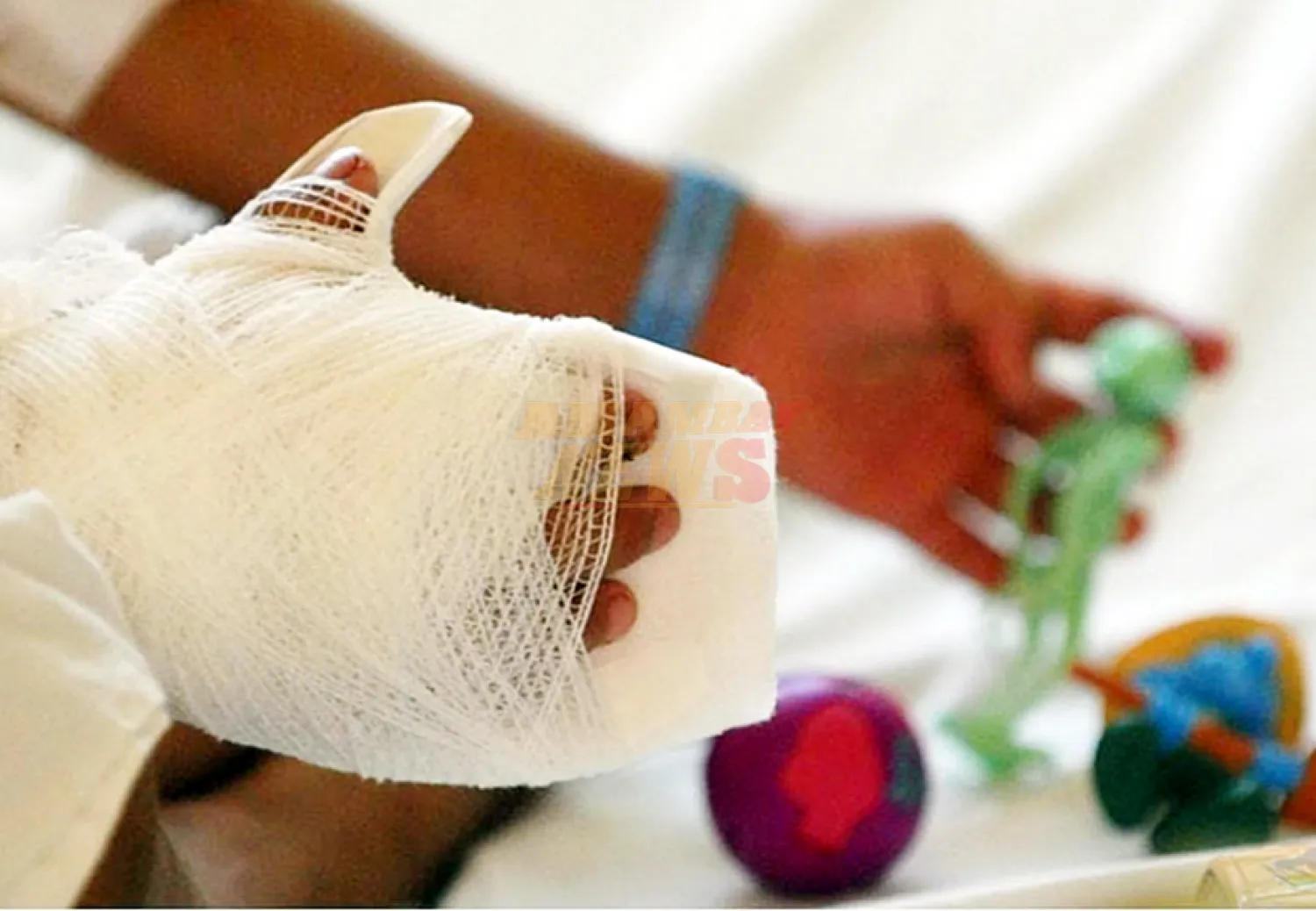 Capitán Bado: Niñas sufren quemaduras por pirotecnia, padres fueron imputados