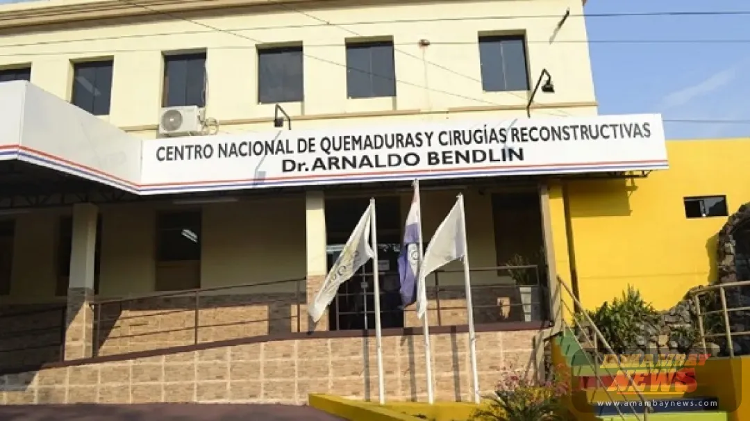 Explosión de globos de helio deja a cuatro jóvenes con quemaduras en Lambaré