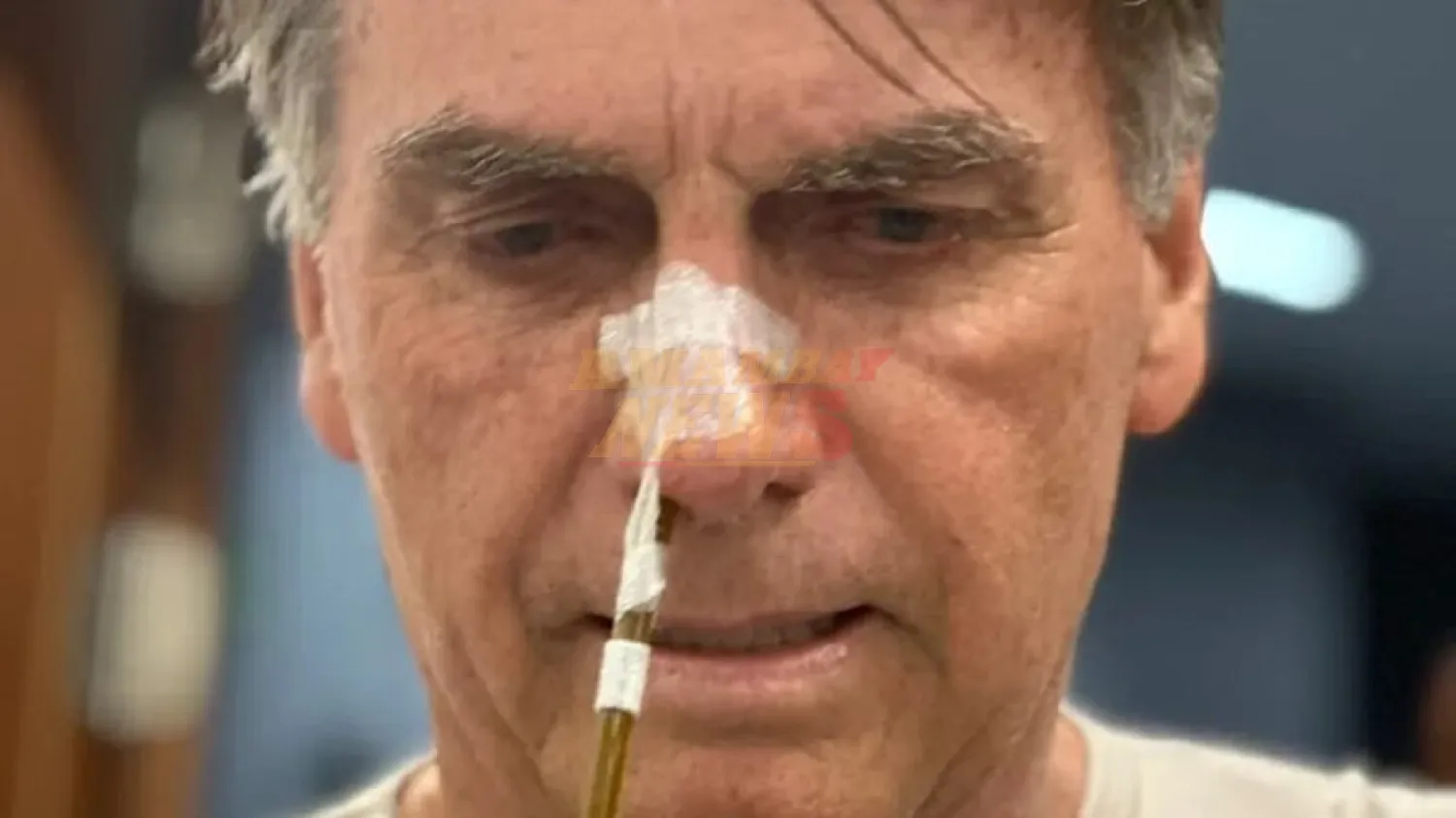 El Supremo autoriza la cirugía a Bolsonaro y rechaza su pedido de prisión domiciliaria