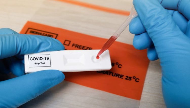 Covid-19: Salud registra cero muertes por tercera vez en el año