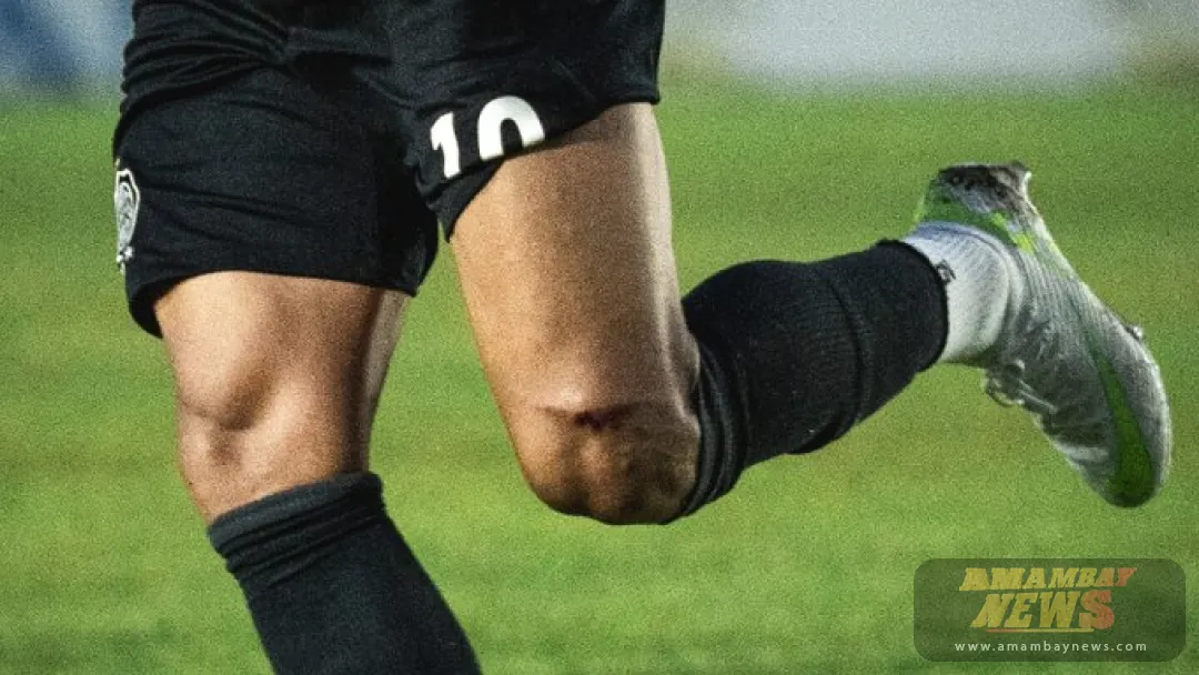 Fuerte reacción en Olimpia: Así quedó la rodilla de Derlis González