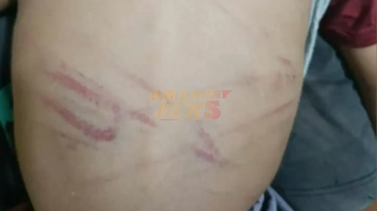 Una mujer es señalada por golpear con cable a su hijastro de 3 años y queda detenida en Capiatá