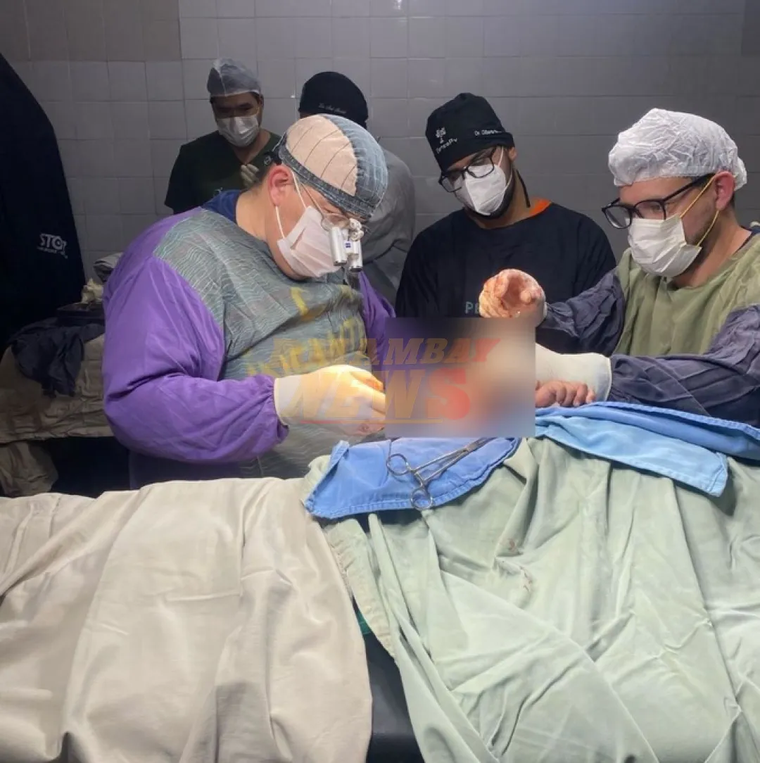 Realizan exitoso primer reimplante de brazo en paciente pediátrico de Alto Paraná