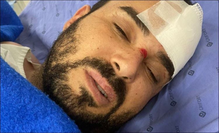 Brasileño baleado en el micro centro de PJC  está fuera de peligro