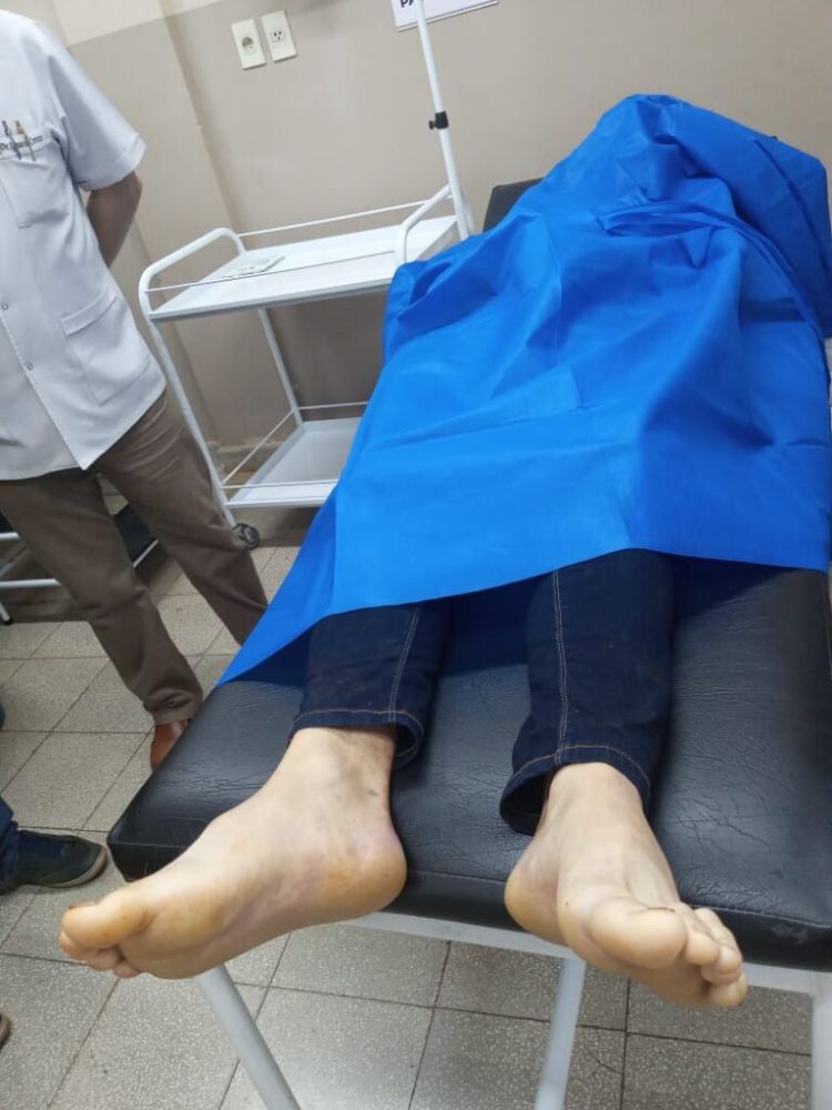 Joven fallece tras caer desde el tanque de agua que estaba limpiando en Presidente Franco