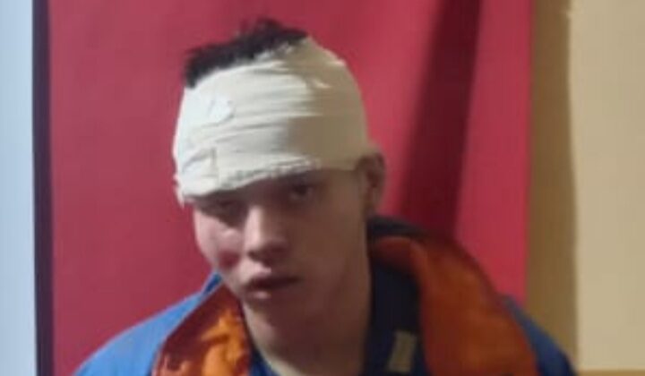 Su revólver hizo varios clic pero no disparó, y motochorro sufrió golpiza y abandono