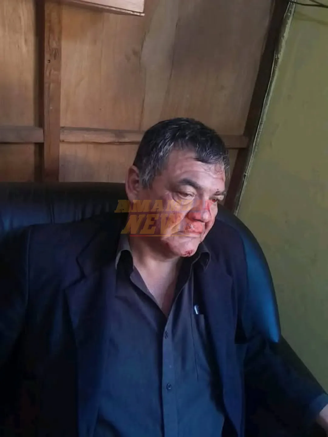Guardia de local nocturno fue brutalmente agredido en Presidente Franco.