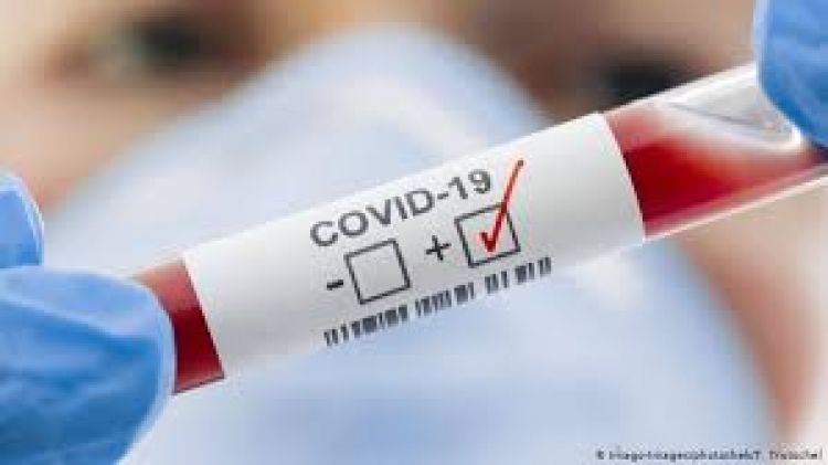 Salud Pública registra 70 contagios y 4 nuevas muertes por Covid-19