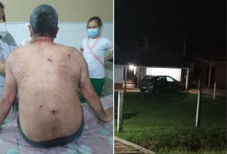 Grupo criminal atentó contra un docente, quien logró sobrevivir pero está grave