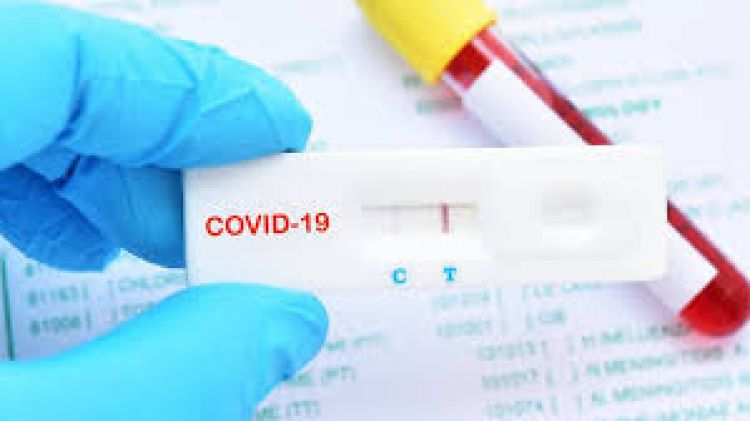 Salud Pública reporta 1.414 nuevos casos positivos y 17 fallecidos por coronavirus