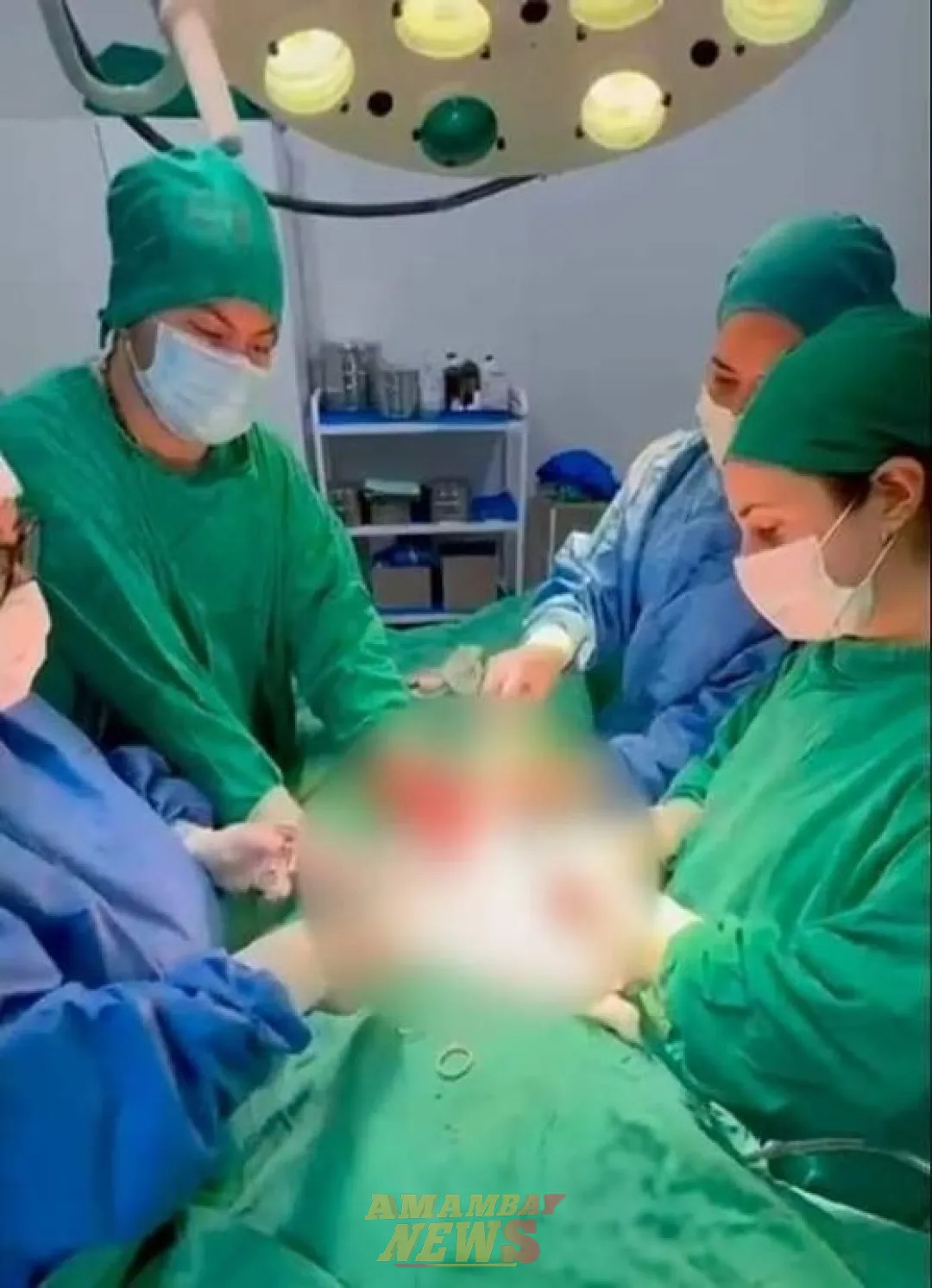 Extraen gran cantidad de parásitos de intestino de un joven en San Ignacio