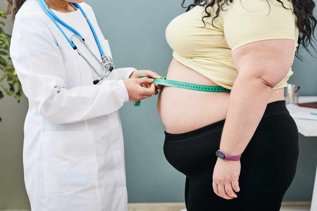 Obesidad: la epidemia del siglo XXI