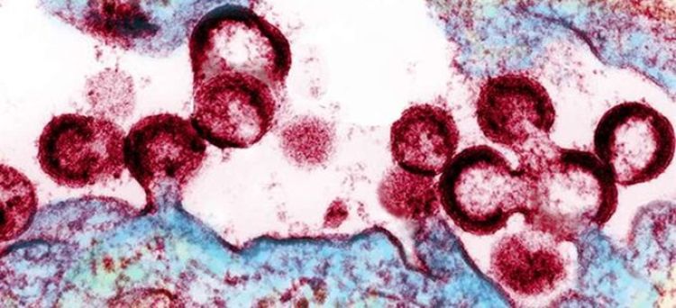 Descubren nueva variante más virulenta y transmisible del VIH