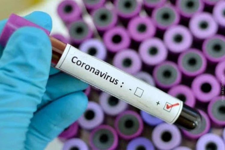 Salud Pública reporta 822 nuevos casos positivos de coronavirus y 22 fallecidos