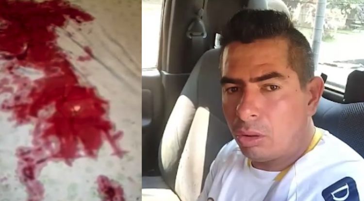 Adolescentes fueron apuñalados por su excuñado en Ciudad del Este