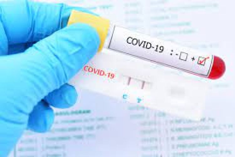 Ministerio de Salud reporta una nueva muerte y 29 contagios por Covid-19